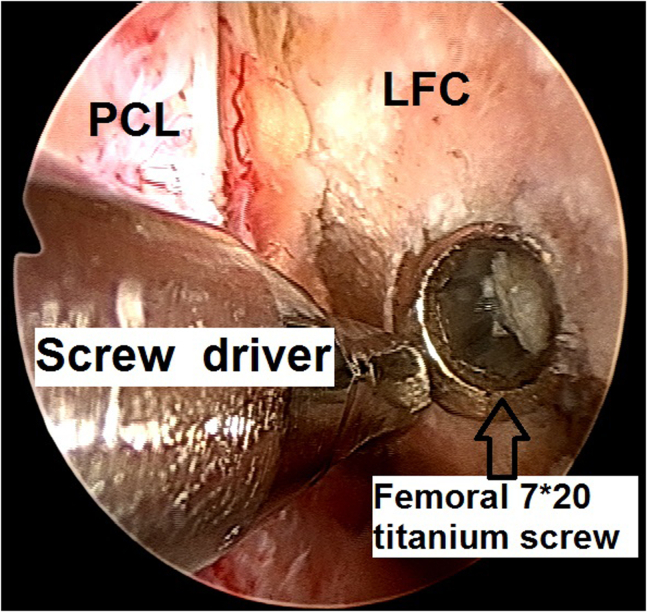 Fig 14