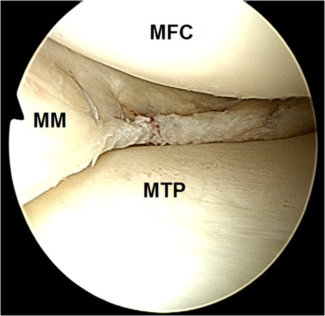 Fig 19