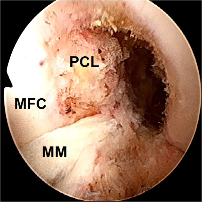 Fig 13