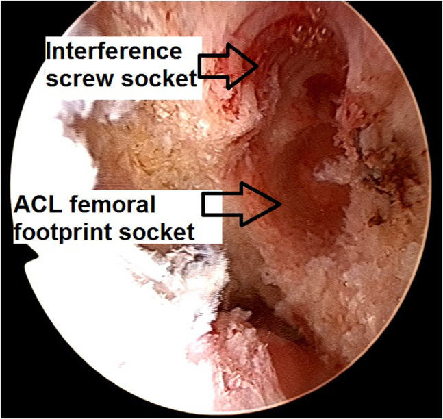 Fig 16