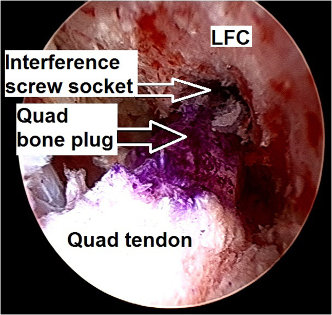 Fig 22