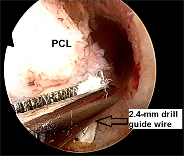 Fig 17