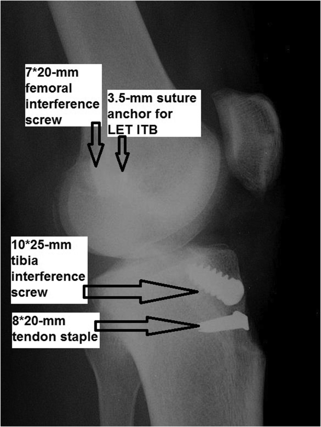 Fig 27