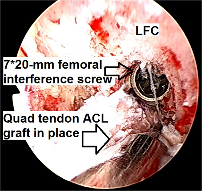 Fig 23