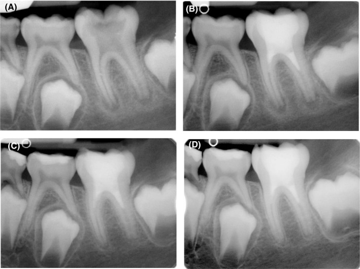 FIGURE 2