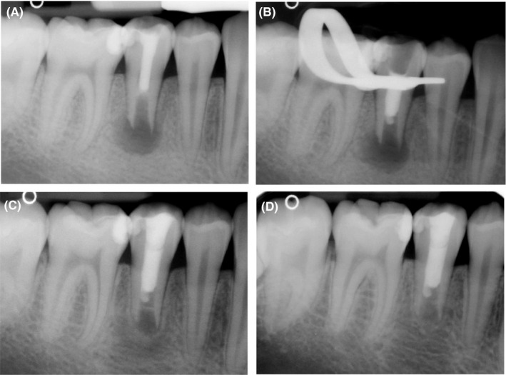 FIGURE 1