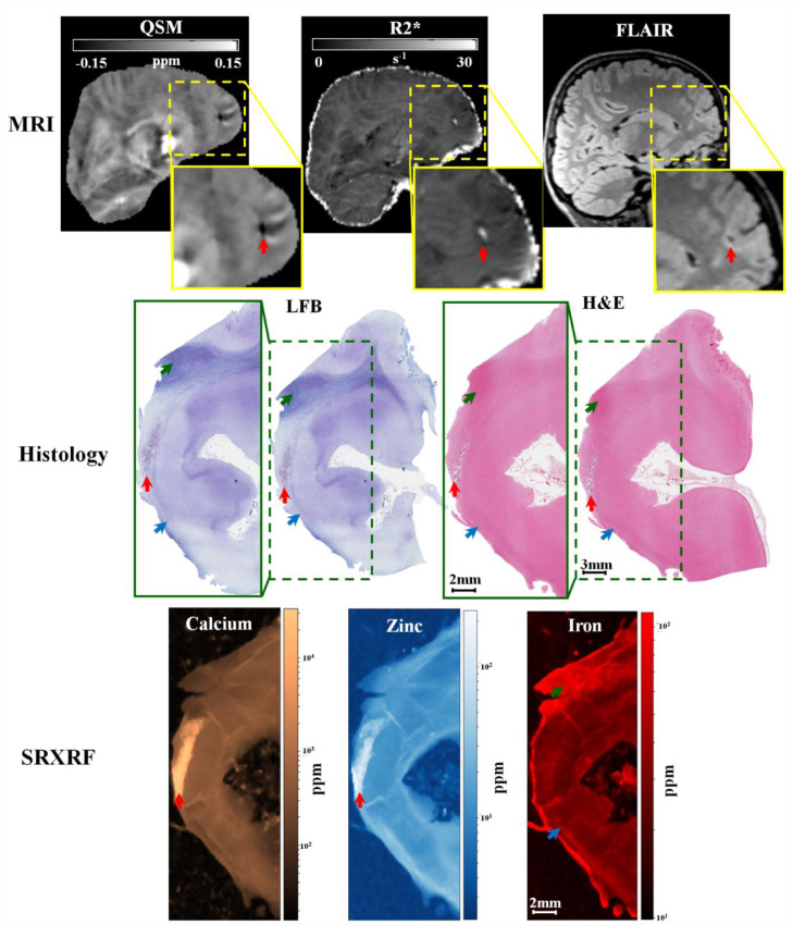 Fig. 3