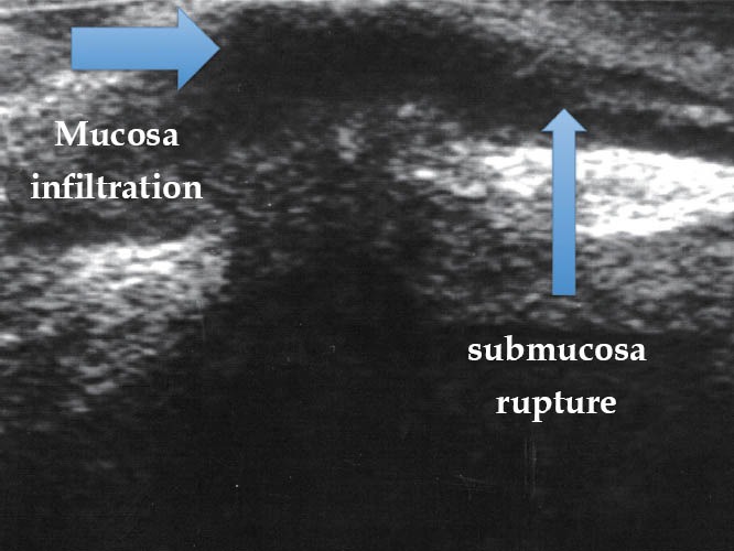 Figure 17