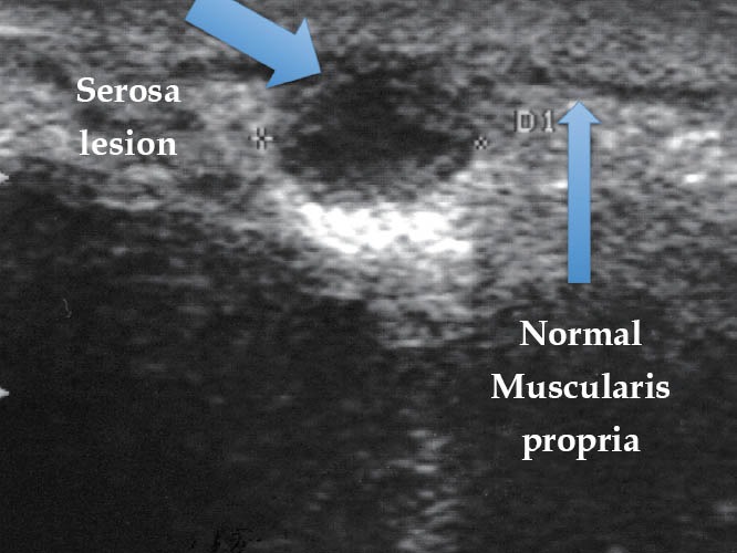 Figure 14