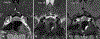 FIG. 2.