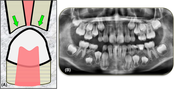 FIGURE 14