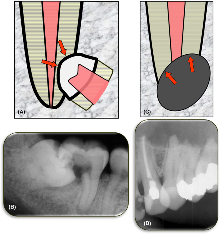 FIGURE 12