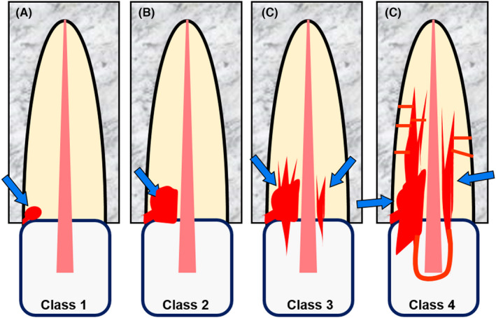 FIGURE 10