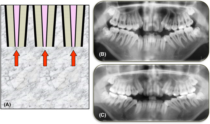 FIGURE 15