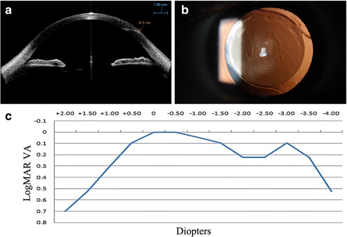 Fig. 3