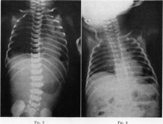 Fig. 3., Fig. 4