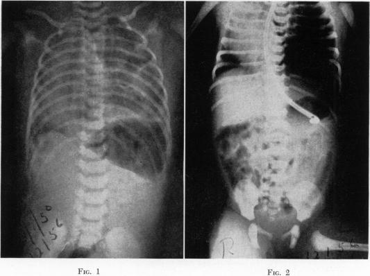 Fig. 1., Fig. 2.