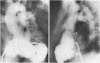 67