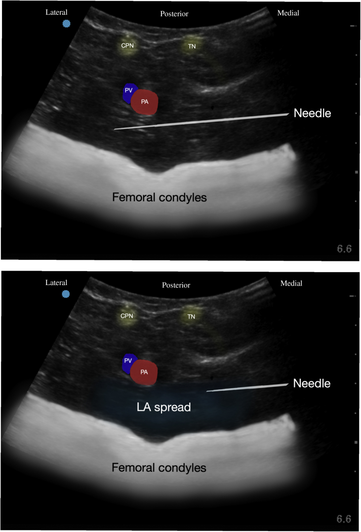 Fig 4