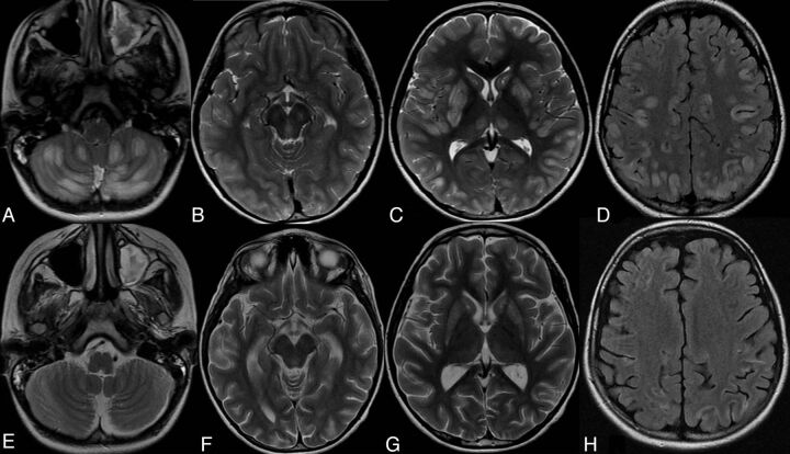 Fig 2.