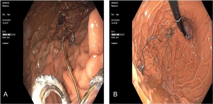 Figure 4: