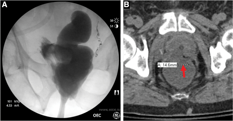 FIG. 1.