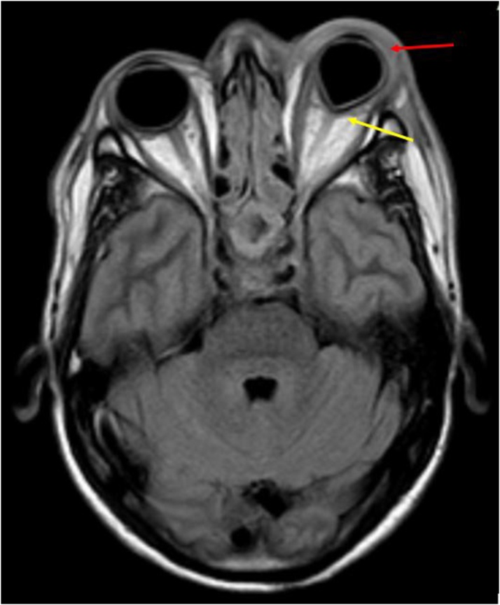 Fig. 15