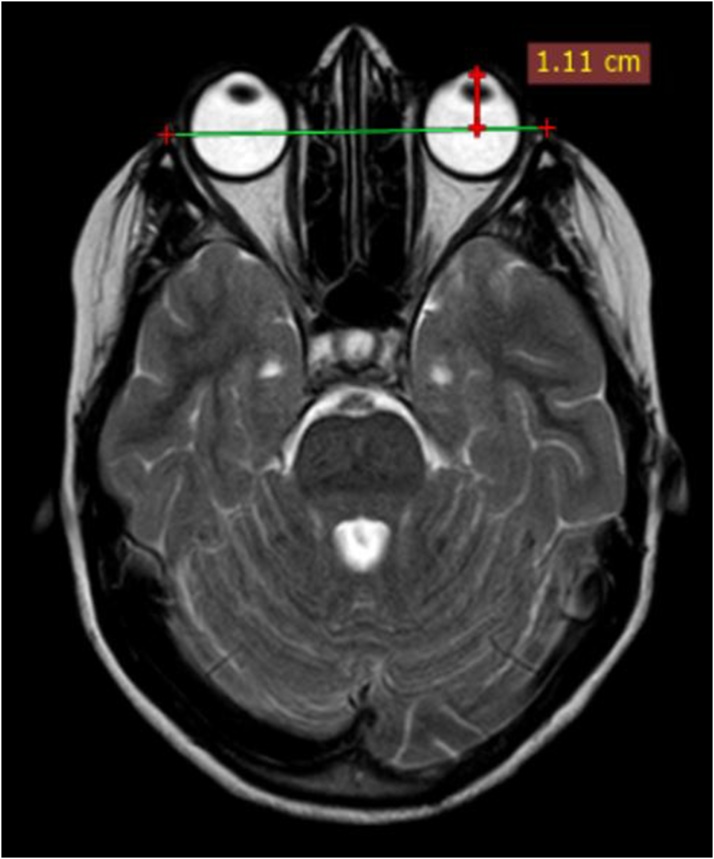 Fig. 5