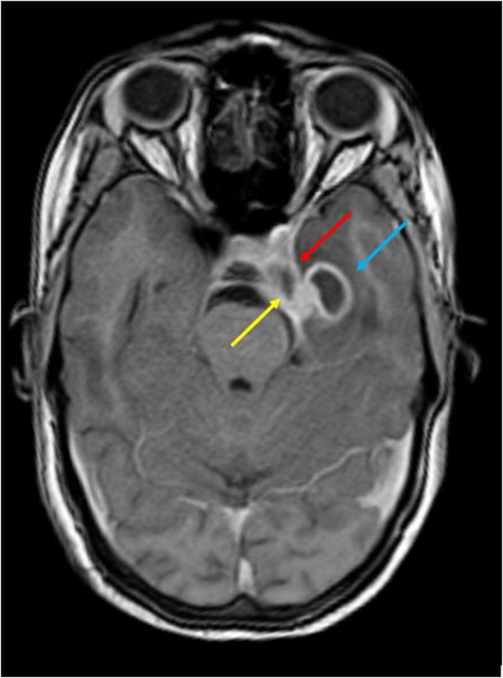 Fig. 12