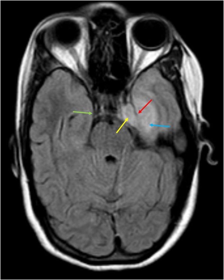 Fig. 10