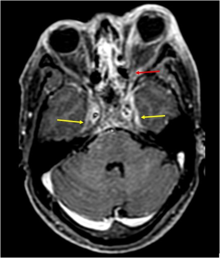 Fig. 18