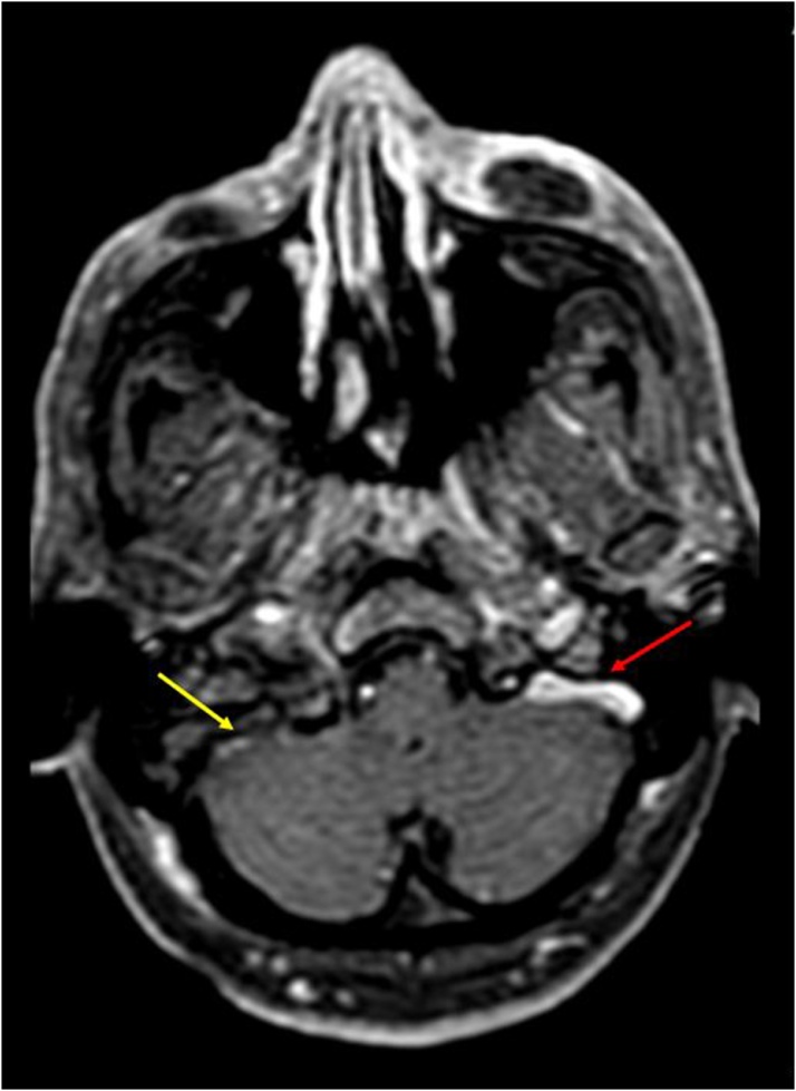 Fig. 6