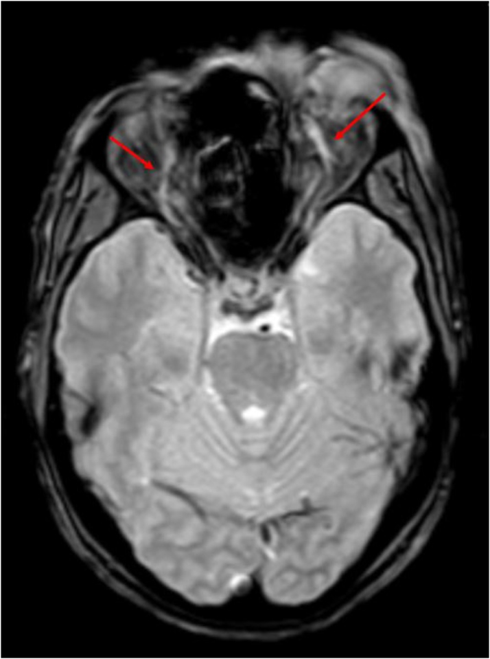 Fig. 16