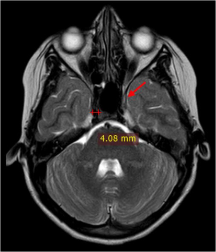 Fig. 3