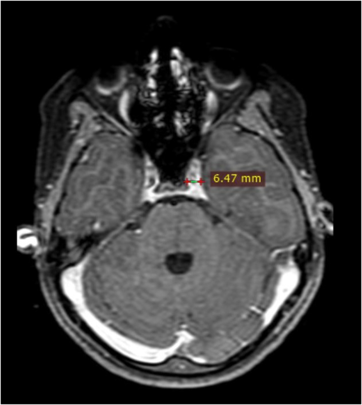 Fig. 2