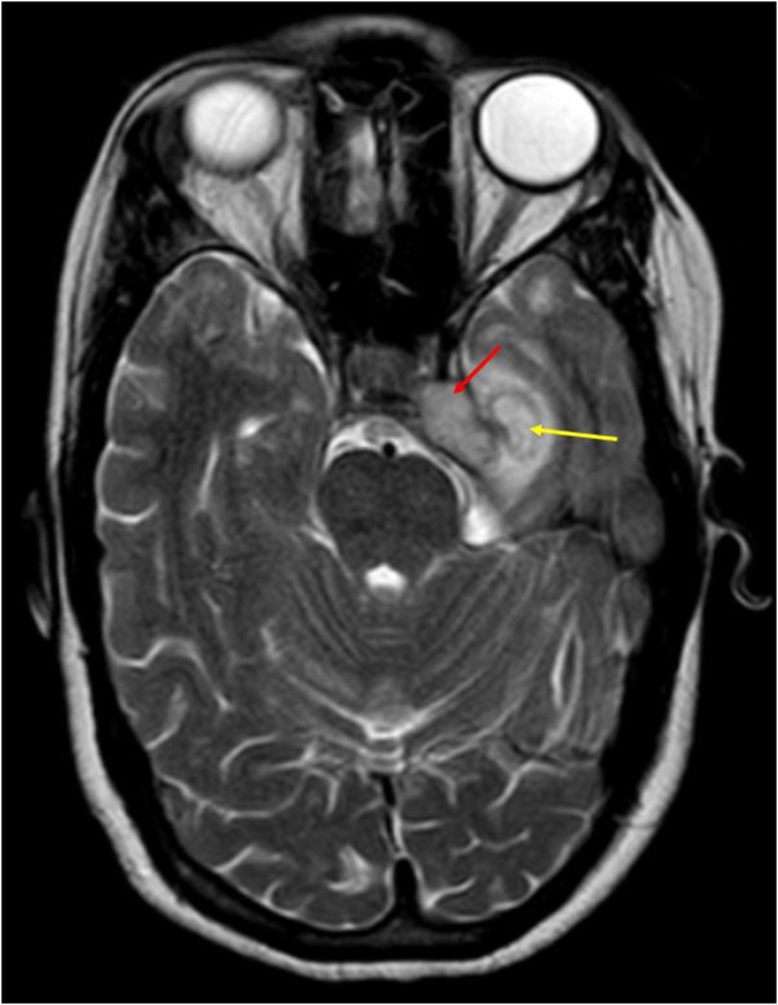 Fig. 11