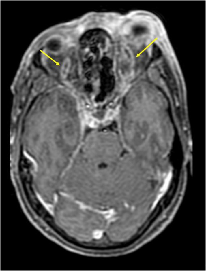 Fig. 17