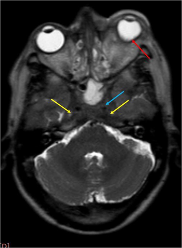 Fig. 14