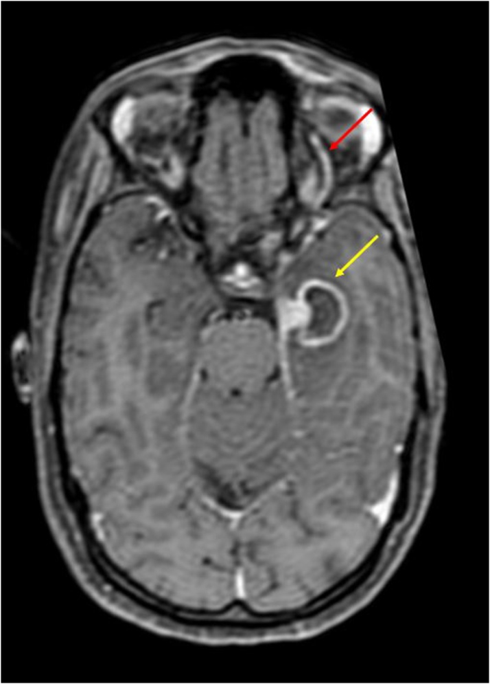 Fig. 13