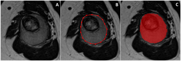 Figure 1