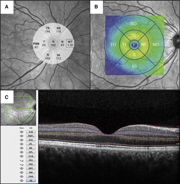 Fig. 1