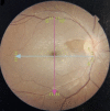 Fig. 2