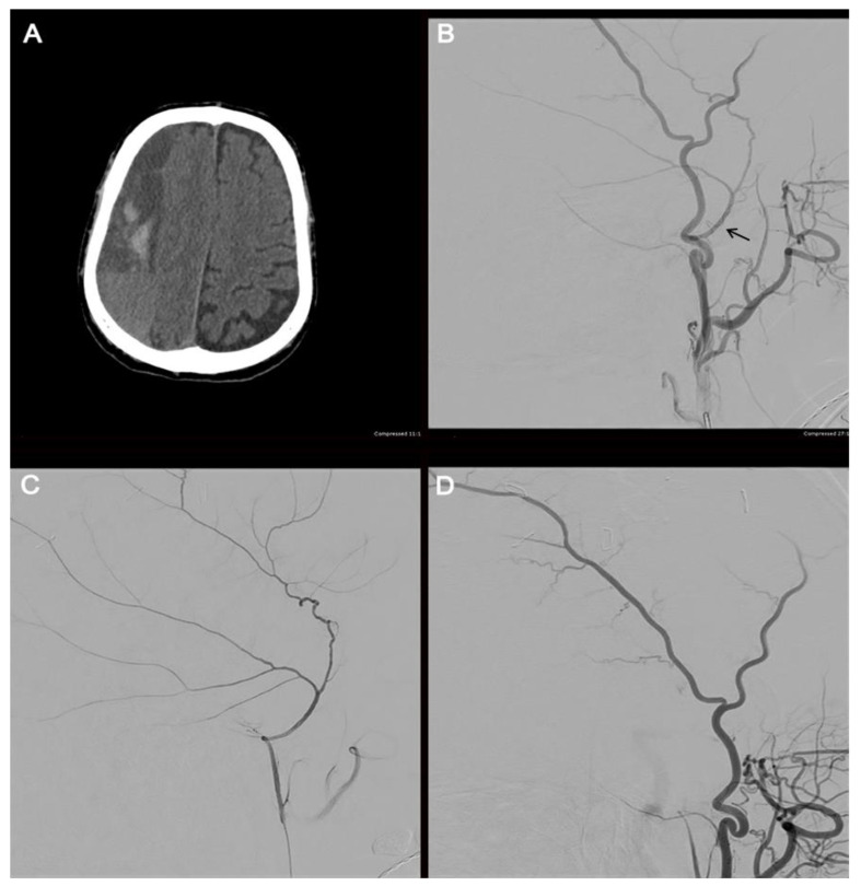 Figure 4