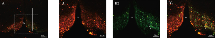 Figure 1