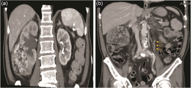 Fig. 1: