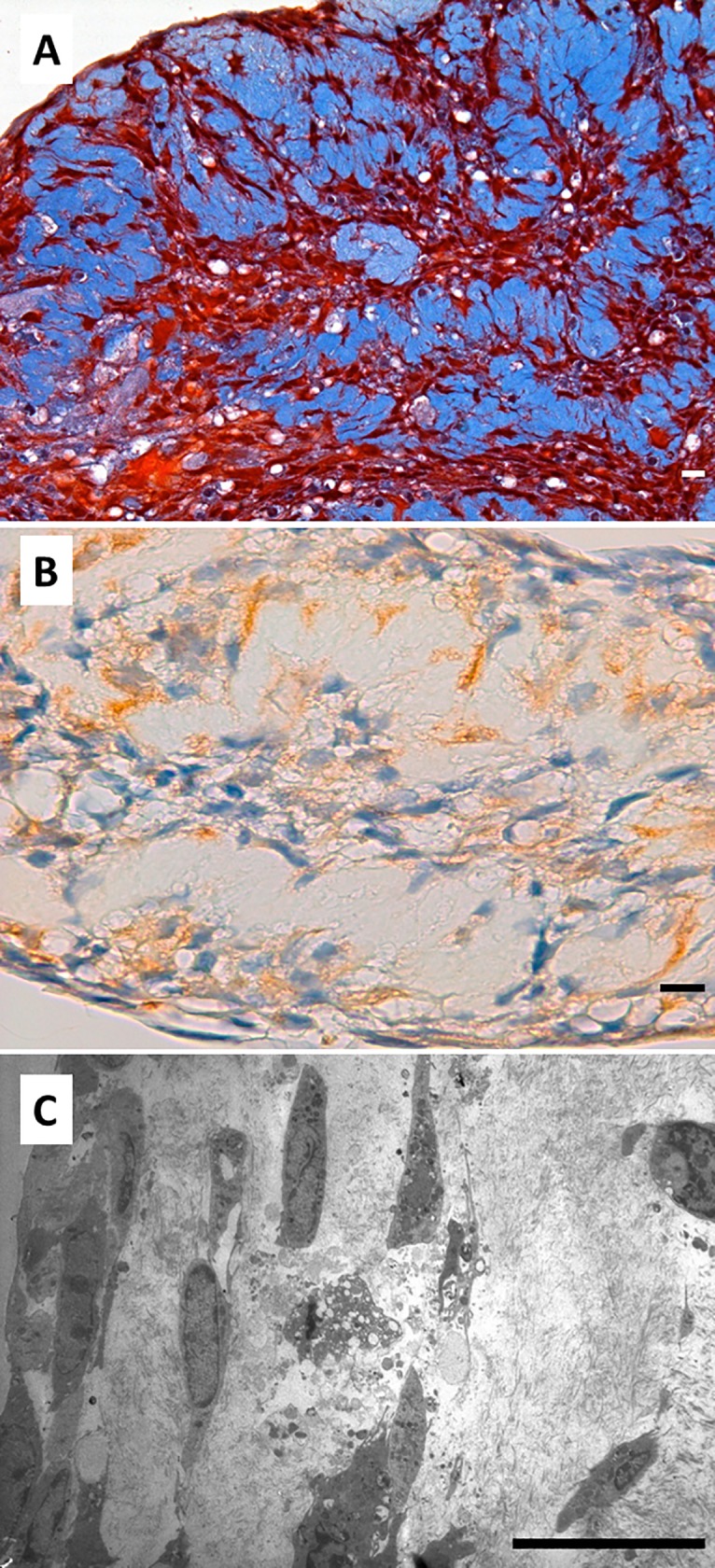 Fig 11