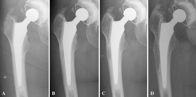 Fig. 1A–D