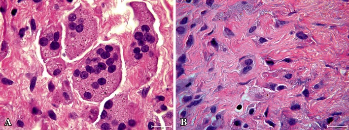 Fig. 2A–B