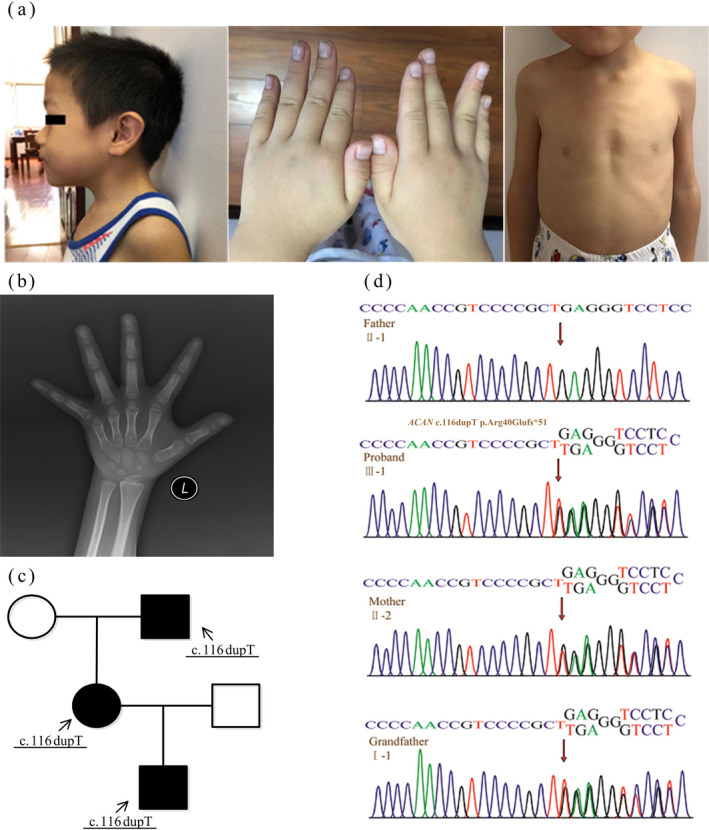 FIGURE 1