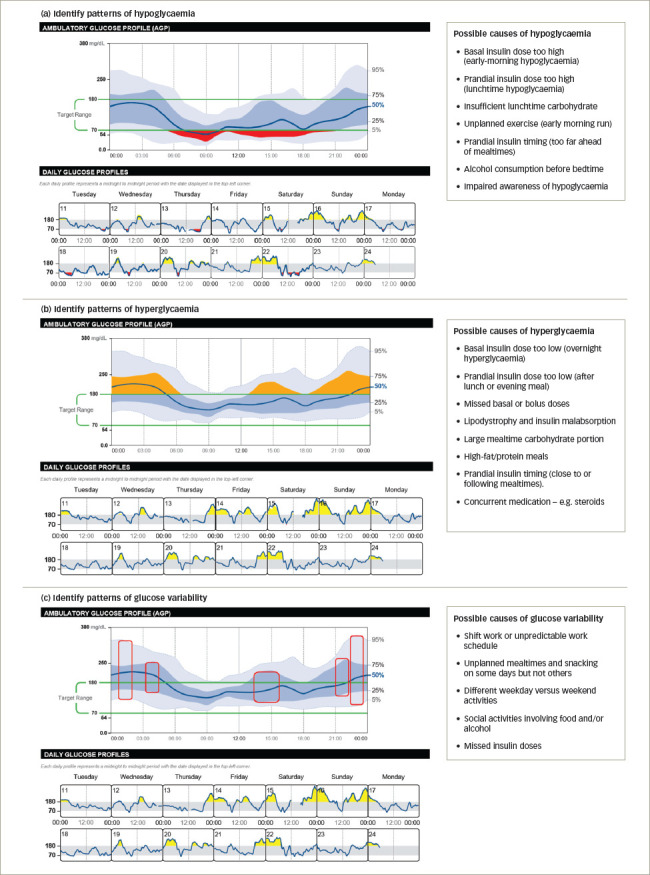 Utilizing the New Glucometrics: A Practical Guide to Ambulatory Glucose ...